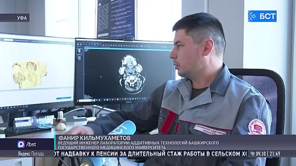 В Уфе участнику СВО восстановили часть лица после боевой травмы