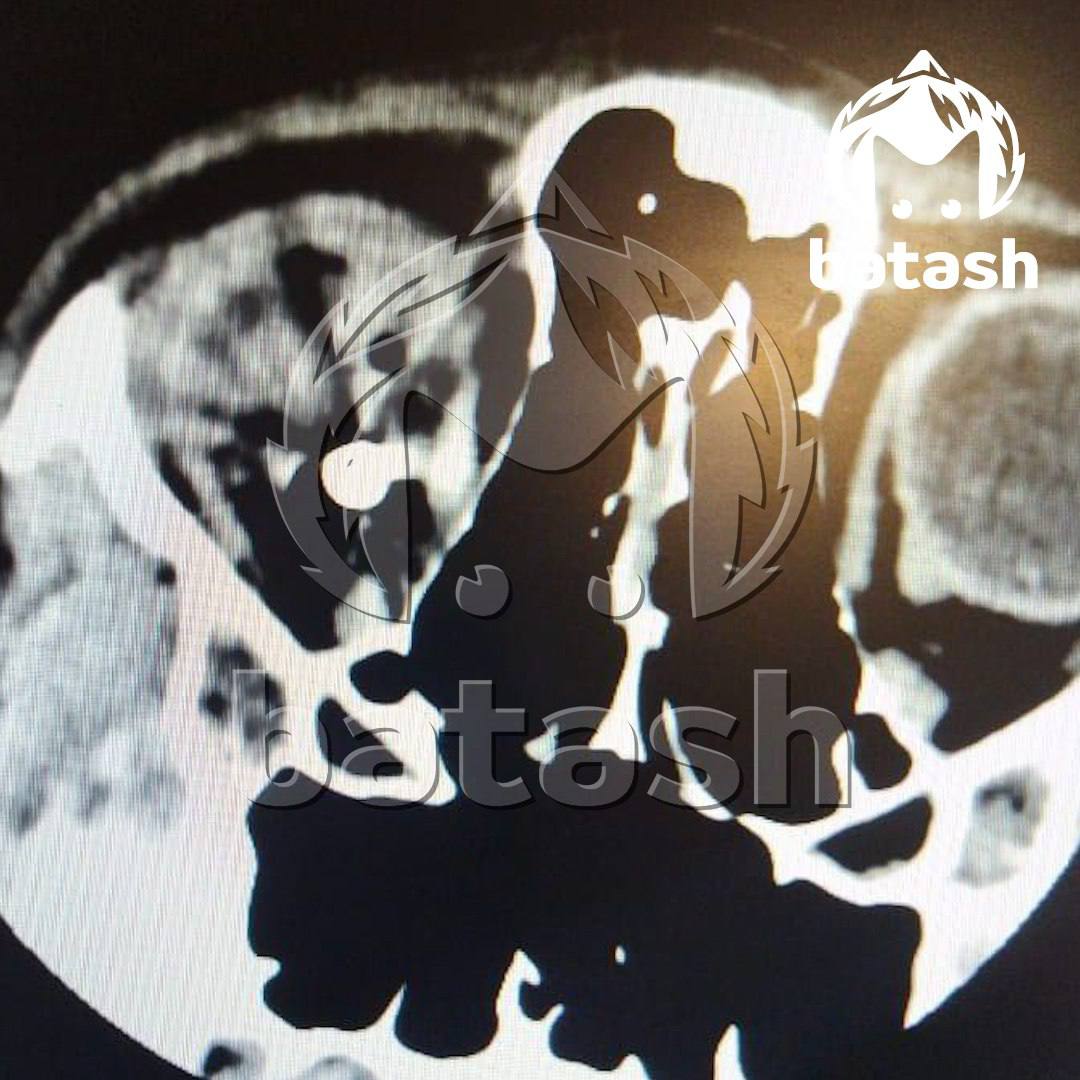 В Стерлитамакском районе следователи СК устанавливают обстоятельства травмирования ребенка в результате выстрела из пневматического пистолета