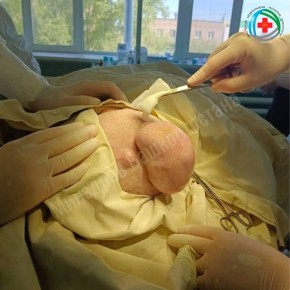 Спали пациентку. В Бирске врачи провели операцию 77-летней женщине