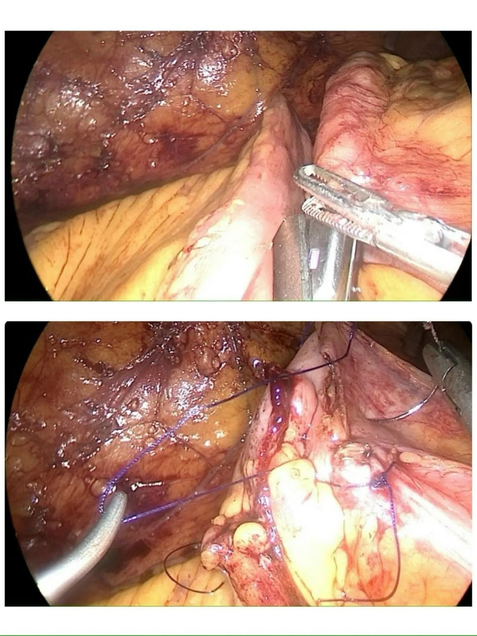 Уникальная операция в Стерлитамаке Уникальная операция в Стерлитамаке