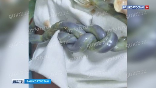 Малыш со сплетенной в косичку пуповиной родился в Уфе