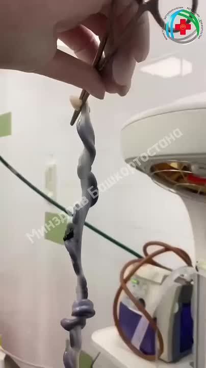 � �������� ������� ����� � �������� ������� ��������� � 150 �� ������ 40-70 ��. � ��� ���� ������� ����