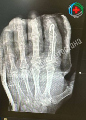 ����� ������� ��������. ������ ������������� ������� ���� ����� ������� �� ����� ������ �� �����