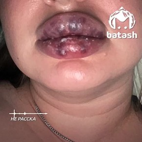 ���������� ����������� ���� ������ ����� ����� �����