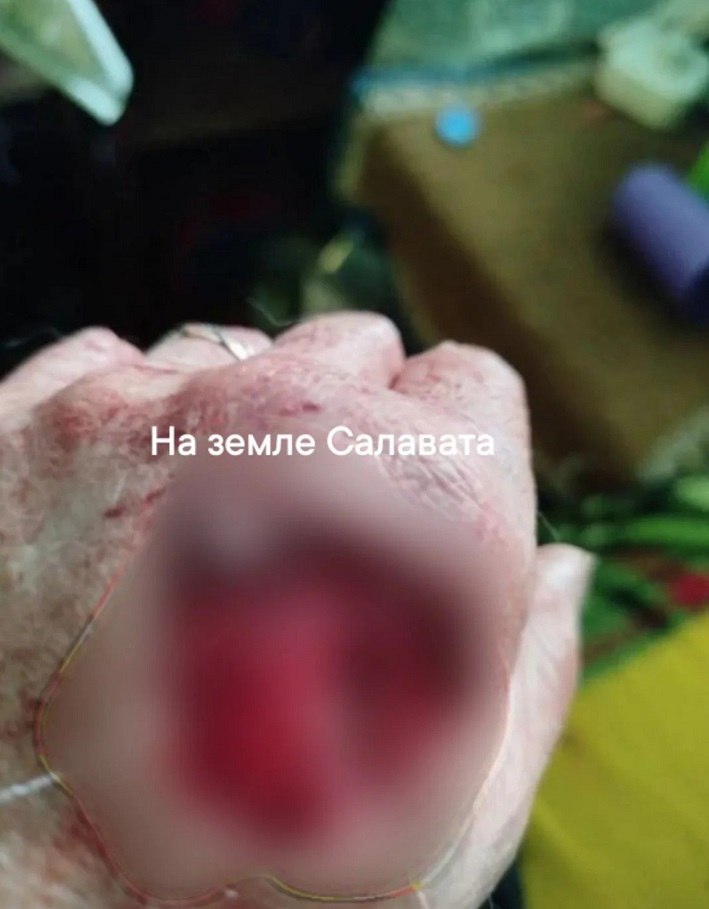 В Башкирии алабай растерзал на улице женщину