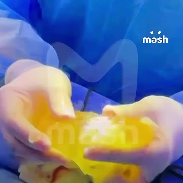 ����������� ����� ���������� � �������-������� �� ��� �� ����� ����������