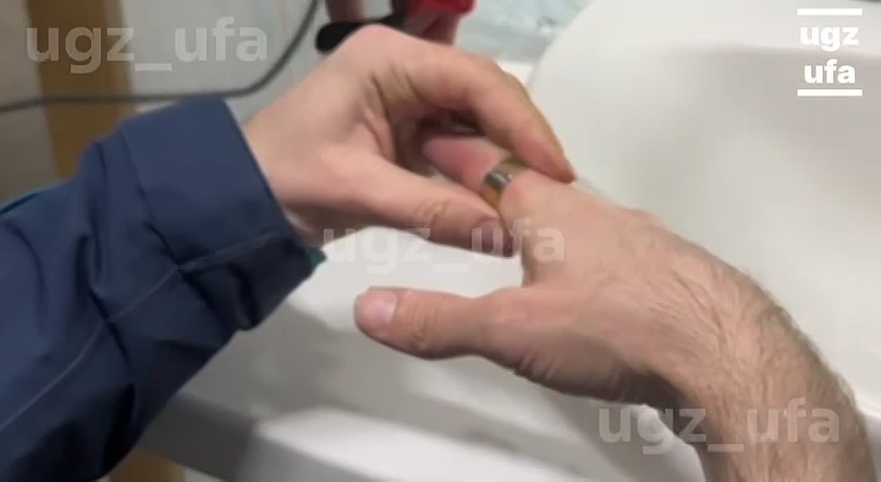 Уфимец проснулся с неприятным сюрпризом на пальце