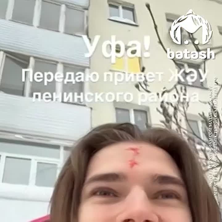 Упавший с крыши снег рассёк модели лоб в Уфе