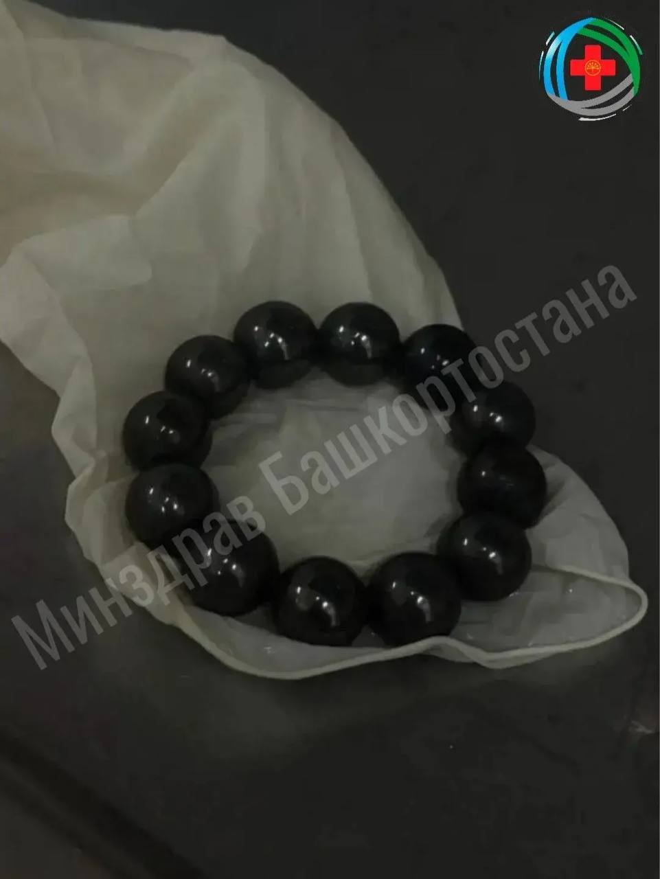 В Уфе 10-летняя девочка проглотила магнитные шарики