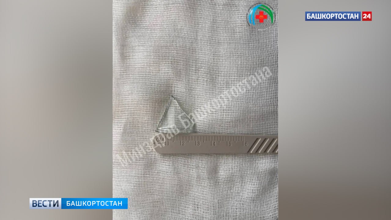 Уфимец выпил жидкость из стеклянной бутылки и случайно проглотил осколок