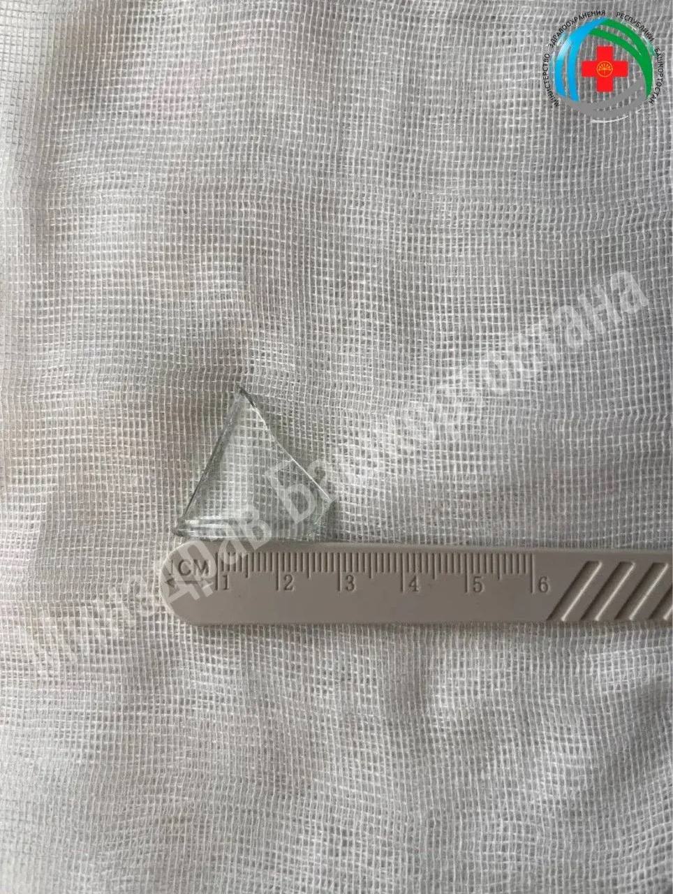 Проглотил кусок стекла. В Уфе «скорая» доставила мужчину в больницу с болью за грудиной