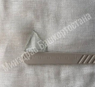 Уфимские врачи спасли жизнь мужчине, который проглотил крупный осколок стекла