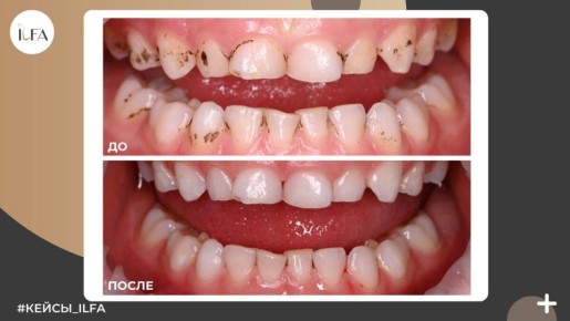 ���� �������: ��� ��� ����� � ��� ��� ���������� �������?