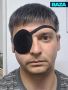 Уфимец лишился глаза, пока лечил отслойку сетчатки — врачи не справились за семь операций и удалили орган