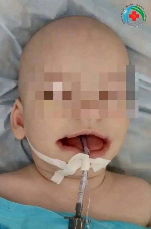 Уфимские медики убрали младенцу лишние расщелины у рта