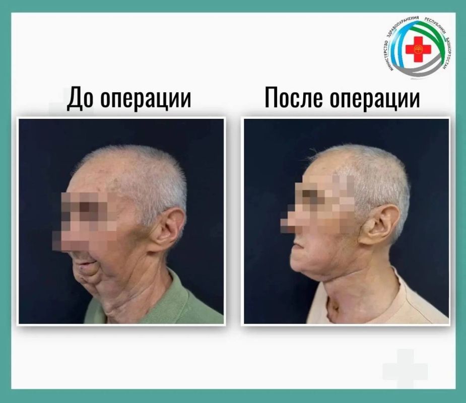 Провели реконструктивную операцию мужчине