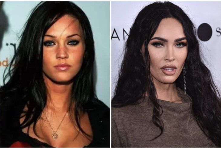 Пластическая хирургия: 7 знаменитостей, которые выглядят лучше с возрастом